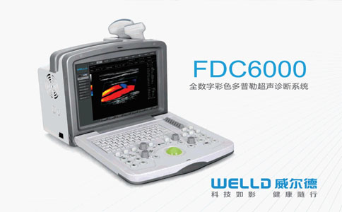 WELLD 威尔德 FDC 6000 型彩超