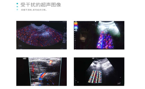 彩超用抗干扰系统